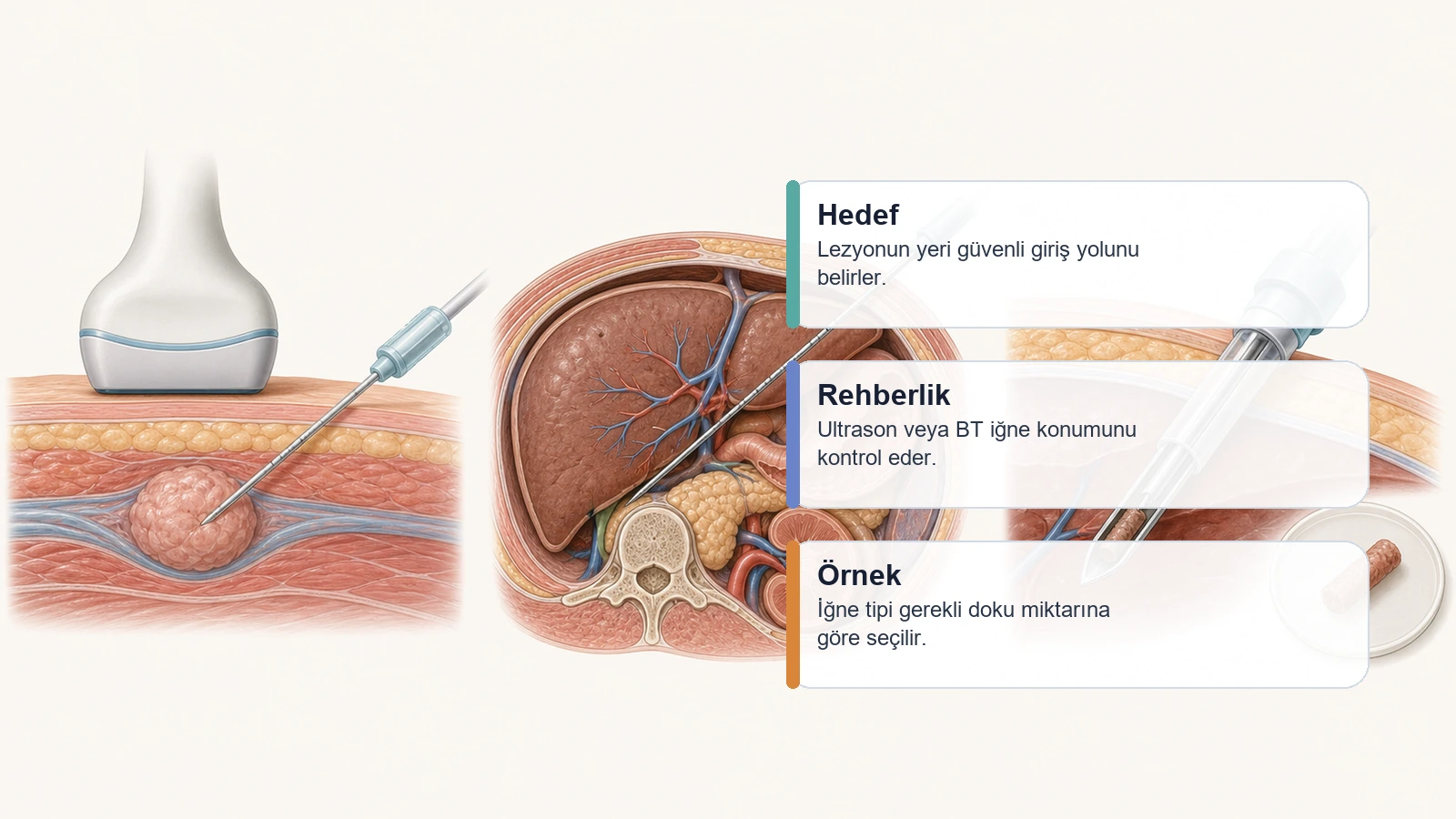 Biyopsi kanseri yayar mı? için ultrason ve BT rehberli biyopsi ile kalın iğne örneklemesini açıklayan premium medikal görsel