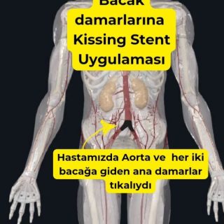 Instagram gönderisi